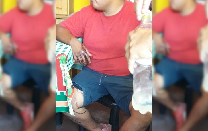 Robó en la casa de un vecino y lo detuvieron por las manchas de sangre que dejó en el camino