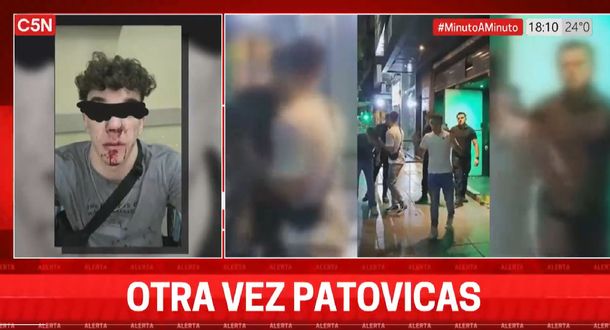 Belgrano: un joven fue brutalmente golpeado por un patovica