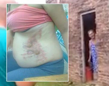 Abuela le tiró agua hirviendo a una embarazada