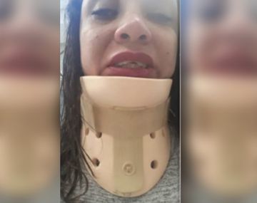 Motochorros desfiguraron a una mujer que iba a su despedida de soltera