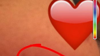 miren sus lolas: la foto de una enferma de cancer que podria salvar vidas miren sus lolas: la foto de una enferma de cancer que podria salvar vidas