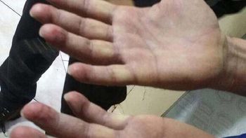 video: asi estaban las manos de perez corradi cuando fue detenido video: asi estaban las manos de perez corradi cuando fue detenido