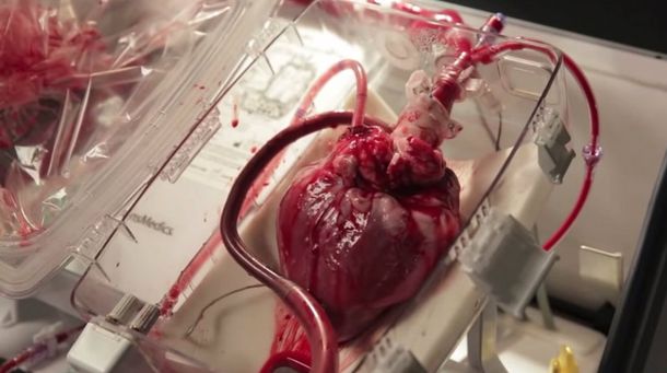 Video: un corazón sigue latiendo artificialmente dentro de una caja