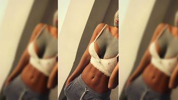 El tratamiento de Noelia Marzol El tratamiento de Noelia Marzol