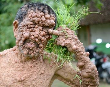 El hombre burbuja hizo un desesperado pedido de ayuda