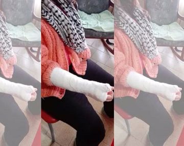 La obligaron a comer pasto y le fracturaron los dedos&nbsp;