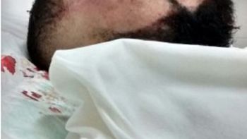 un joven fue brutalmente golpeado por patovicas en un boliche de provincia un joven fue brutalmente golpeado por patovicas en un boliche de provincia