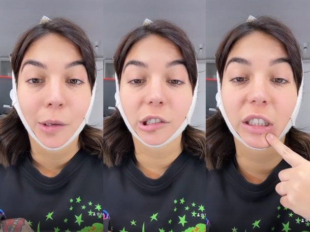 Luciana Milessi sufre secuelas por una cirugía estética: su descargo
