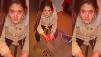 una joven fue brutalmente golpeada por su novio y su suegra una joven fue brutalmente golpeada por su novio y su suegra