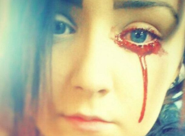 Una adolescente de Inglaterra no para de sangrar por los ojos y no saben por qué