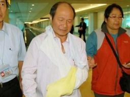 se corto la mano para enganar al seguro y termino preso se corto la mano para enganar al seguro y termino preso