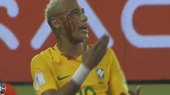 Neymar recibió un codazo en la goleada de Brasil sobre Bolivia. Neymar recibió un codazo en la goleada de Brasil sobre Bolivia.