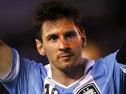 el tremendo golpe que casi le saca un ojo a lionel messi el tremendo golpe que casi le saca un ojo a lionel messi