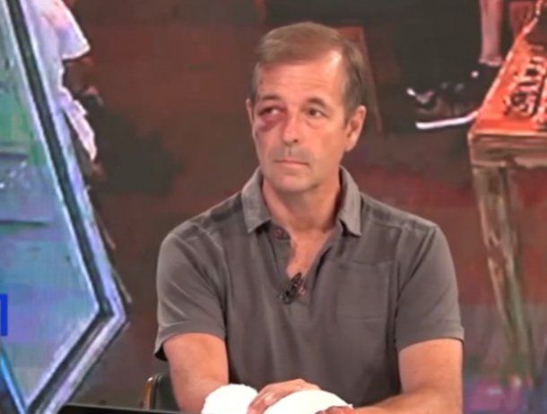 Mal momento: un periodista víctima de un robo debió ser operado de urgencia