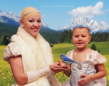 La emotiva Cenicienta sin pelo