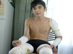 rottweiles atacaron a un joven rottweiles atacaron a un joven