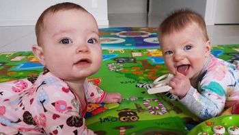 Charlotte y Olivia son las mellizas que fueron gestadas en el inédito embarazo Charlotte y Olivia son las mellizas que fueron gestadas en el inédito embarazo