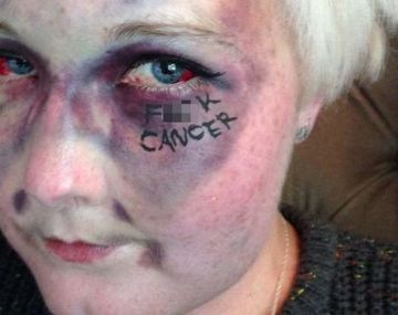 Se saca una impactante selfie para concientizar sobre la enfermedad: mirá la foto
