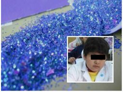 nene que aspiro purpurina, con muerte cerebral nene que aspiro purpurina, con muerte cerebral