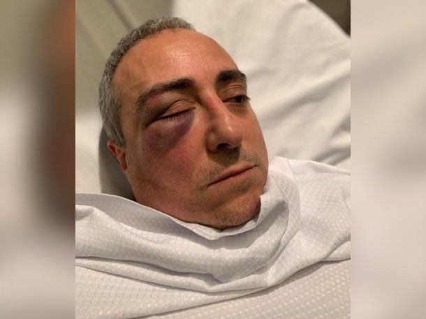 Brutal ataque piraña en Retiro: ocho delincuentes golpearon y robaron a un hombre