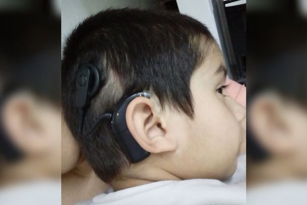 Tiene 4 años, es hipoacúsico y necesita ayuda para comprar un audífono