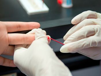 Diagnósticos de VIH en la Argentina