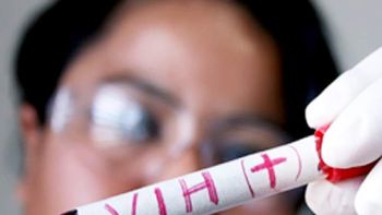 Un brasileño se curó e completamente del VIH solo con medicación Un brasileño se curó e completamente del VIH solo con medicación