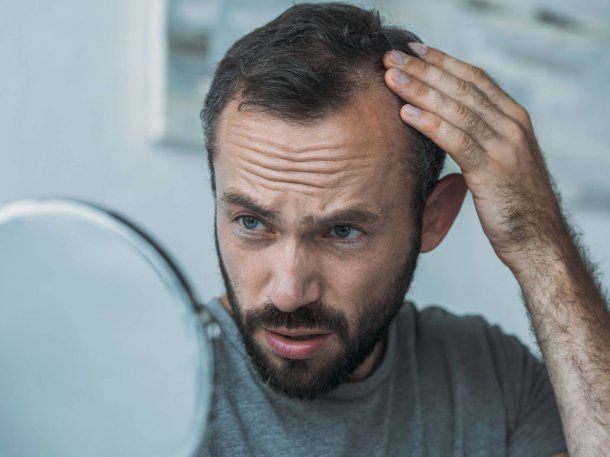 Los hombres que se masturban corren más riesgo de quedarse pelados