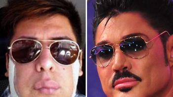 el fan de wanda nara tras los pasos de fort: arranco con las cirugias el fan de wanda nara tras los pasos de fort: arranco con las cirugias