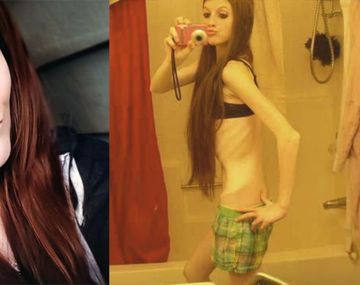 Peligrosa competencia por ser la más flaca