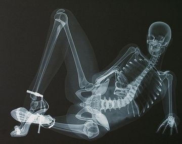 Modelos desnudas y muy sexys a través de rayos x