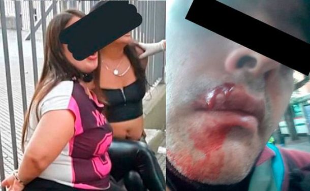 Dos mujeres atacaron a piedrazos e hirieron a un policía que les pidió que se colocaran el barbijo