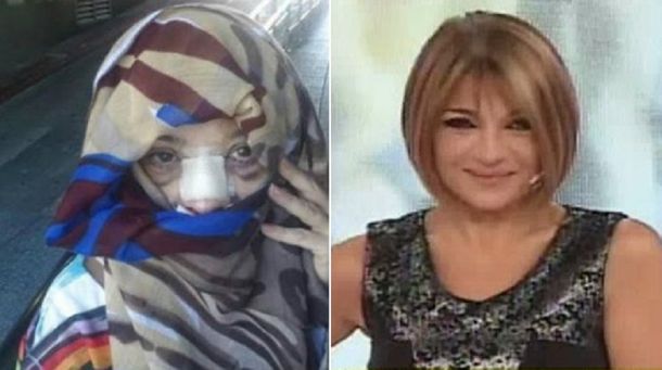 Mirá el antes y el después de las cirugías de Marcela Feudale