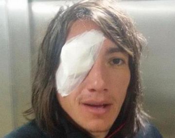 Habló Lugüercio tras la agresión: Me dan ganas de no jugar más