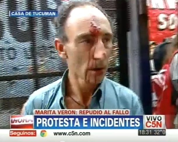 Incidentes en la Casa de Tucumán: hirieron a camarógrafo de C5N