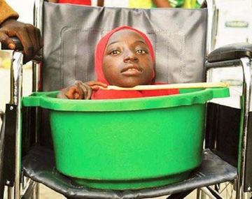 Rahma Haruna&nbsp;la joven sin cuerpo que vivía en un balde