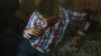 Un grupo de vecinos le desfiguró la cara a un ladrón en Tucumán. Un grupo de vecinos le desfiguró la cara a un ladrón en Tucumán.