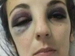 Jugador fue detenido por pegarle a su ex 