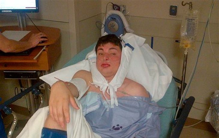 Neonazis golpean y le cosen la boca a un estudiante por ser judío