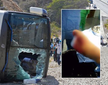 Impactante: Así quedó el pie de Toranzo después del accidente