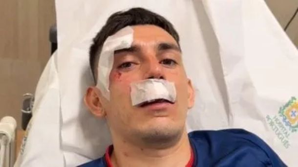 Bombardearon el micro de Fortaleza en Brasil: hay dos argentinos heridos