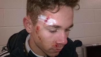 le arruino la cara: mira esta brutal patada en escocia le arruino la cara: mira esta brutal patada en escocia