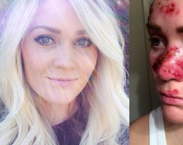 Solía ir a la cama solar cinco veces por semana