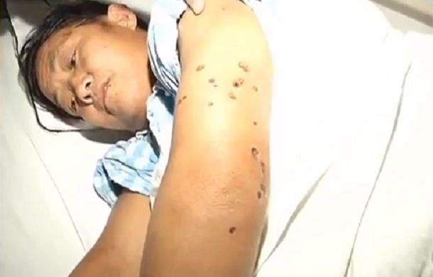 China: 41 muertos por una epidemia de avispas gigantes asesinas