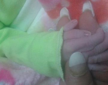 Una beba nació en Tucumán con seis dedos en su mano derecha.