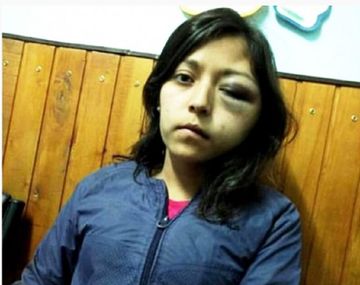 Mariana Arabena fue atacada por Alejandro Patricio Santarrosa