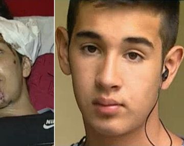 Indignante: al bomberito héroe le roban el celular y le tajean la mano