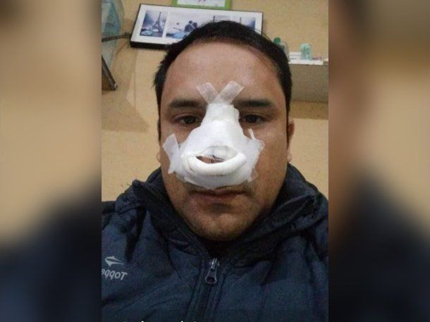 Un pasajero que le aplicó una fuerte trompada en la cara que le provocó el desmayo.