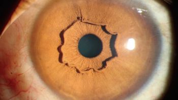 El extraño iris de una mujer china El extraño iris de una mujer china