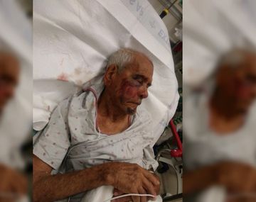 Una mujer golpeó a un mexicano de 91 años con un ladrillo: Volvete a tu país